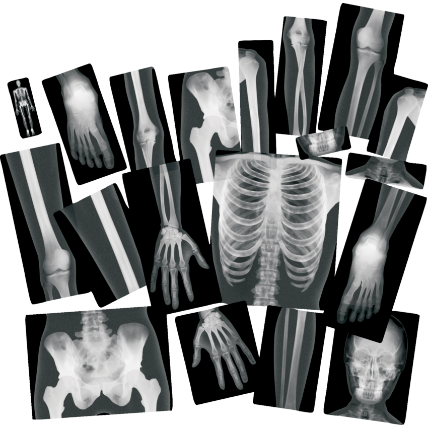 Roylco True to Life Human X-Rays 18/pkg